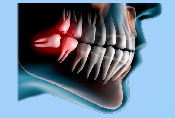 <font size="3" color="#000080">CIRUGIA DENTAL</font>