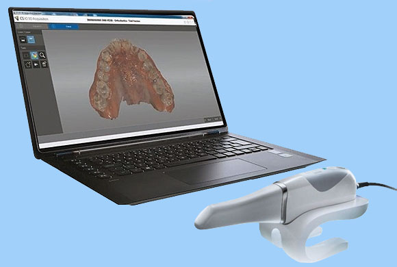 <font size="3" color="#FFFFFF">SERVEIS - ESCÀNER INTRAORAL CARESTREAM</font>